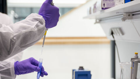 Eine Person hält eine Pipette in ein Reagenzglas